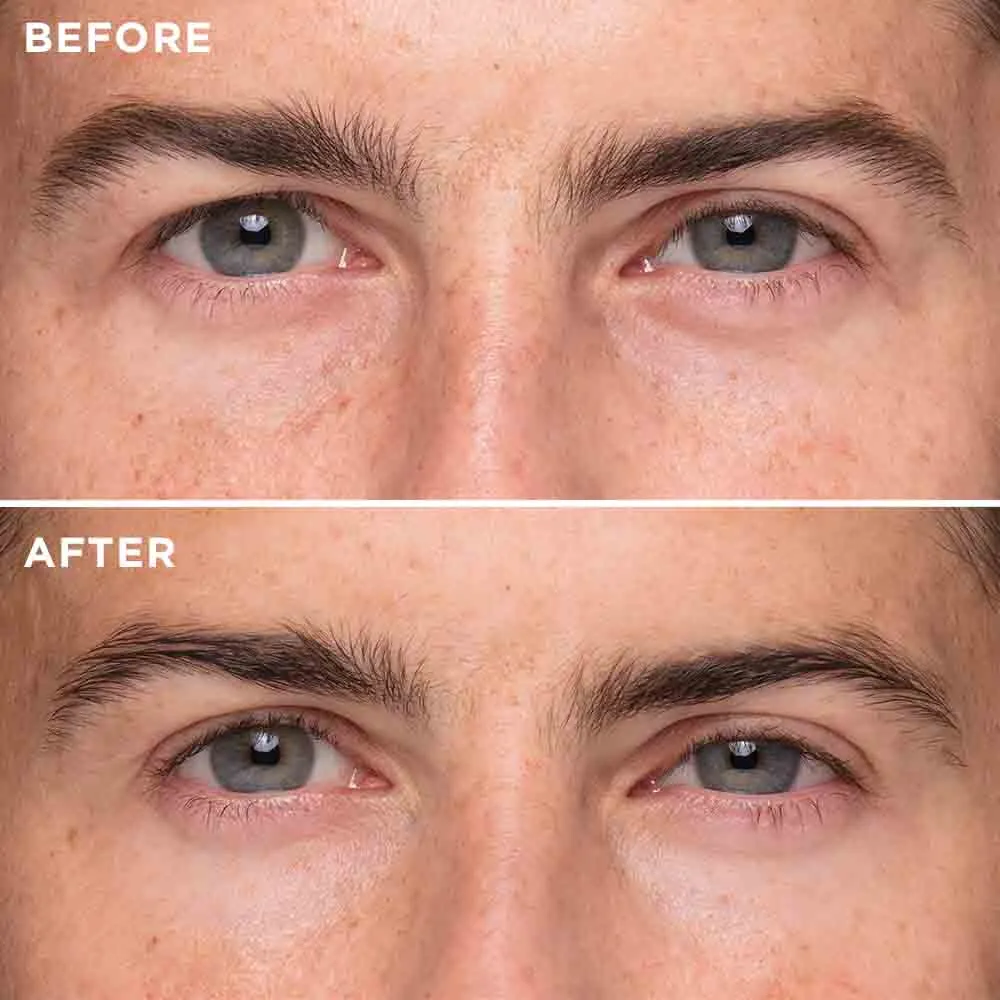 De-Puffing Eye Serum -US