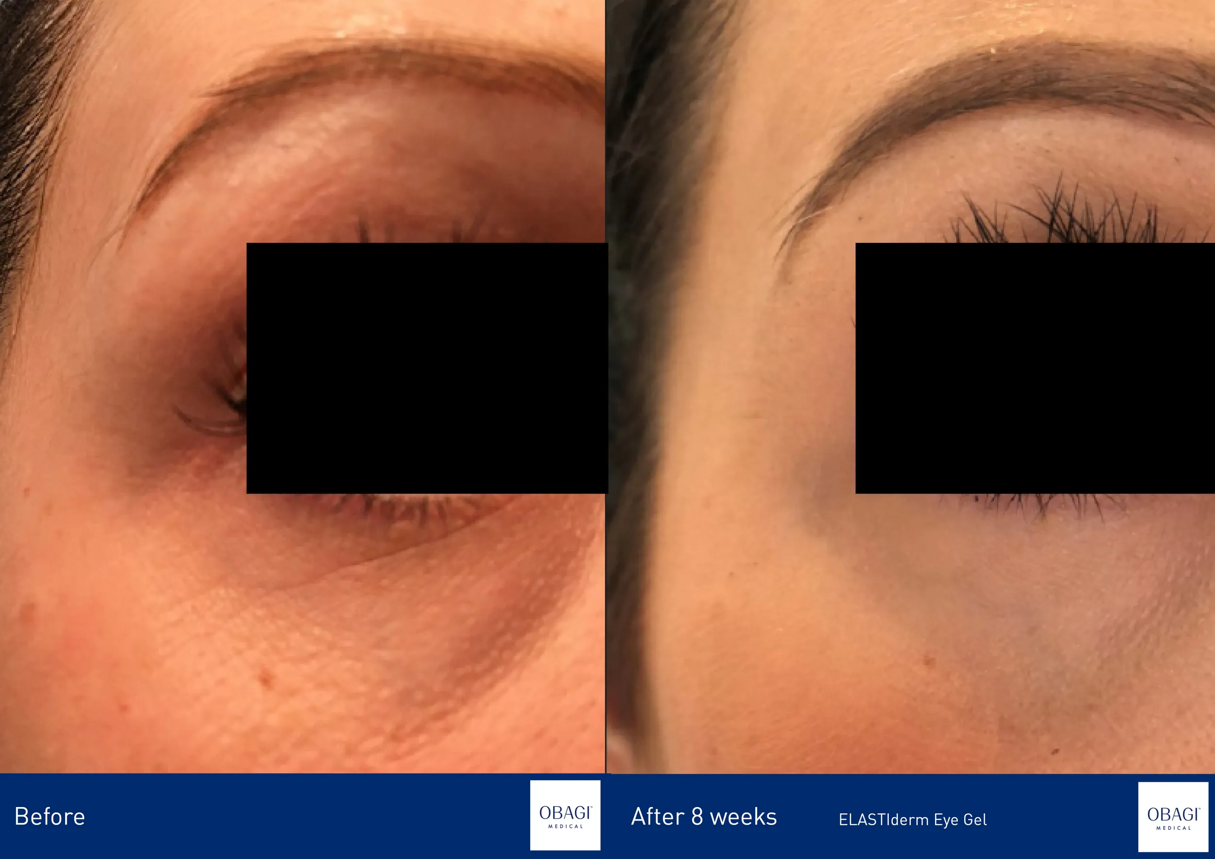 ELASTIderm Eye Complete Complex Serum
