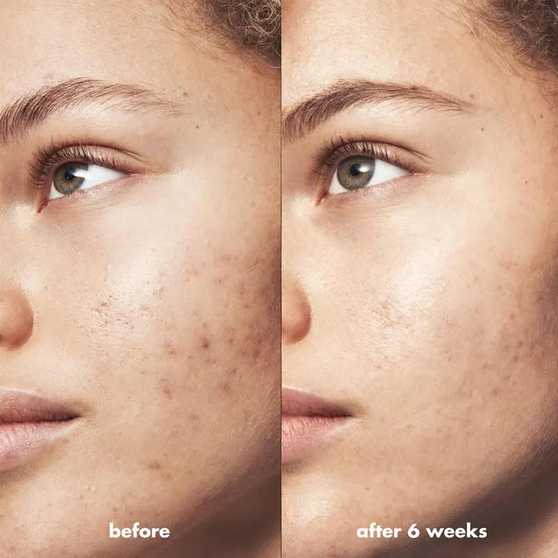 e.l.f. Blemish Breakthrough Blemish Calming Water Cream Discontinued