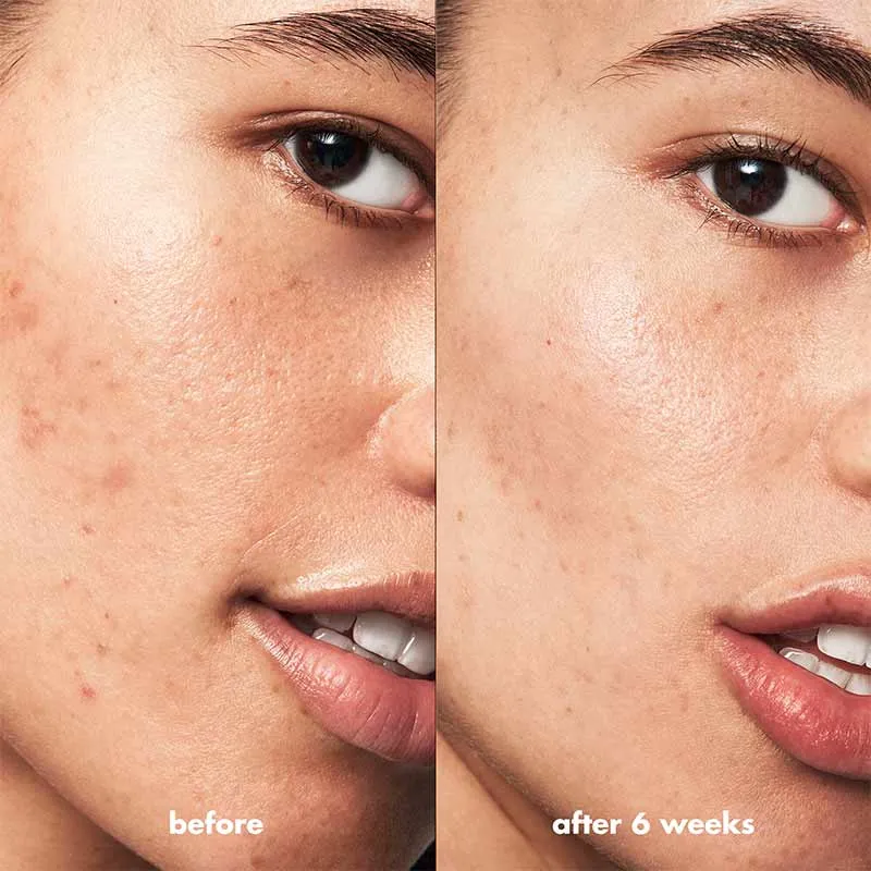 e.l.f. Blemish Breakthrough Blemish Calming Water Cream Discontinued