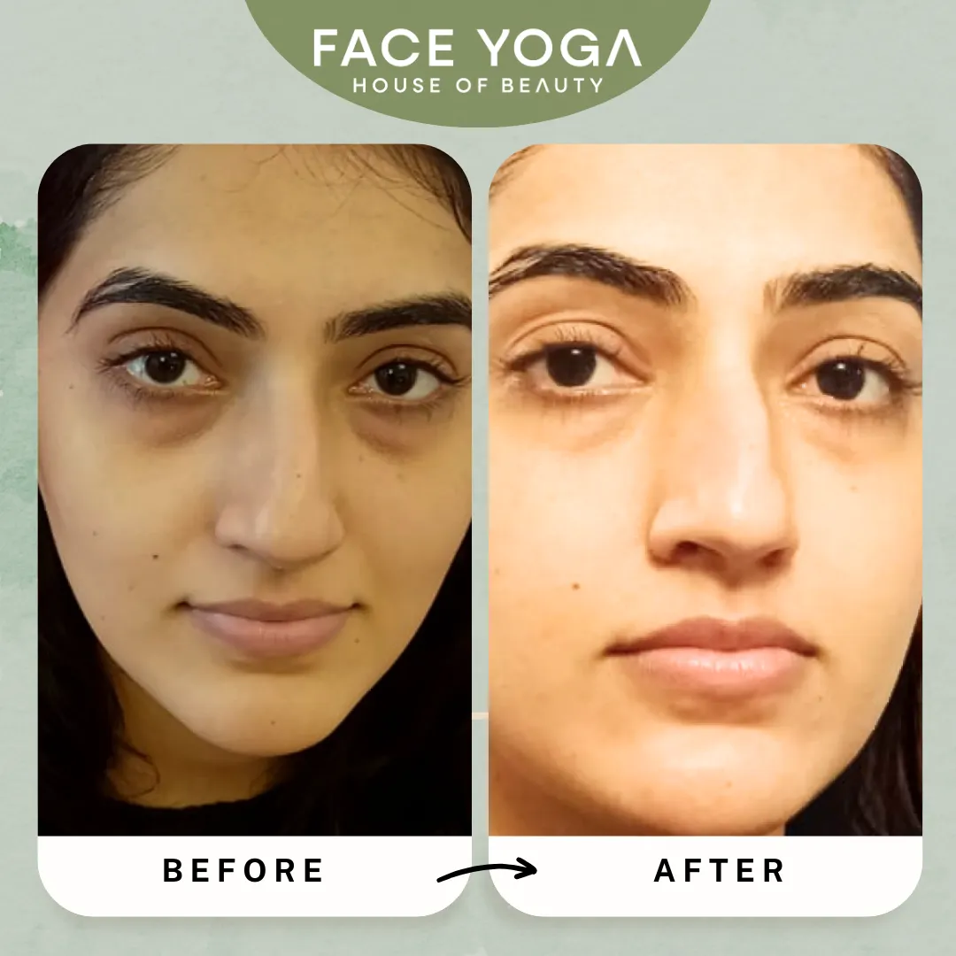 Face Yoga for Dark Circles Reduction (Pre-recorded)