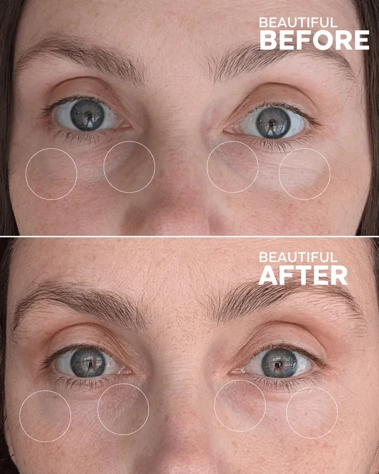 First Light Vitamin C   Caffeine Eye Cream