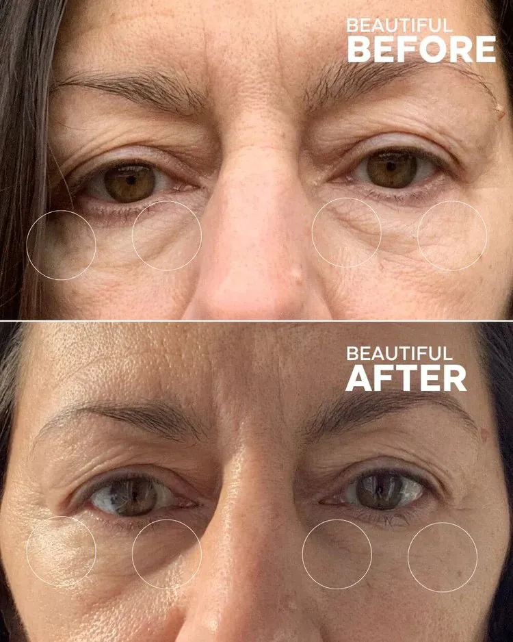 First Light Vitamin C   Caffeine Eye Cream