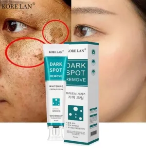 Kore lan Vita age spot removal cream age spot blemishes, 20ml