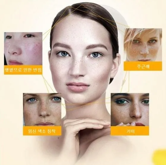 Kore lan Vita age spot removal cream age spot blemishes, 20ml