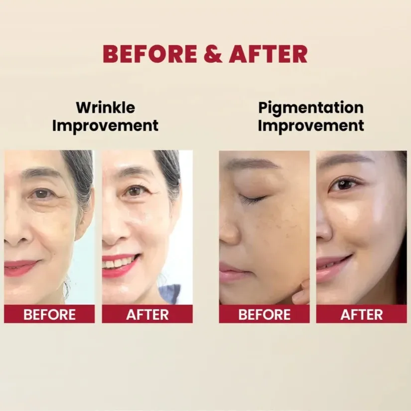 SEOUL 1988 Serum : Retinal Liposome 2%   Black Ginseng