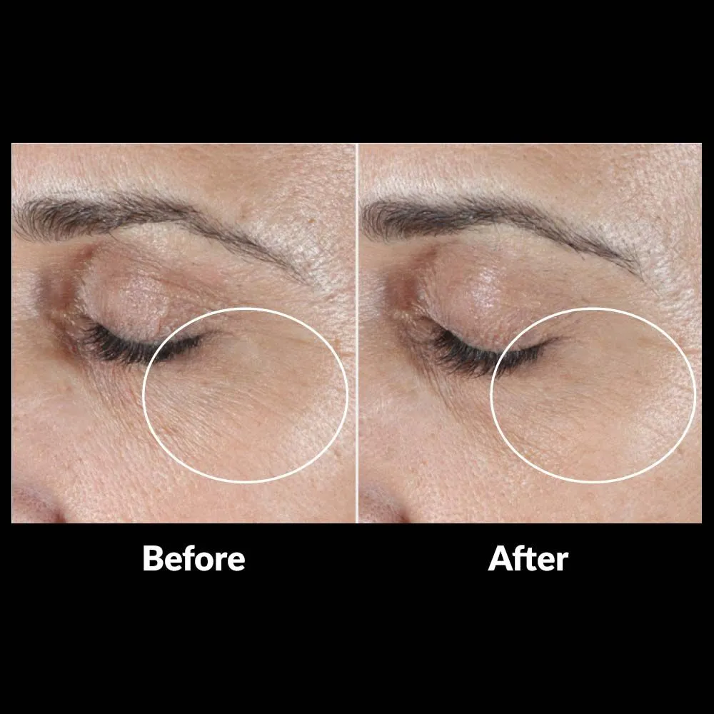 SkinMedica® HA5 Rejuvenating Hydrator